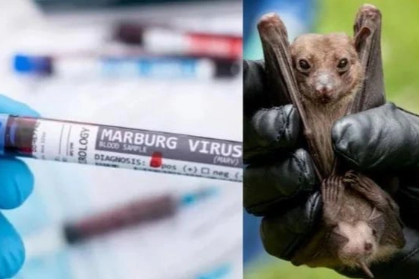 virus-marburg-gay-tu-vong-3