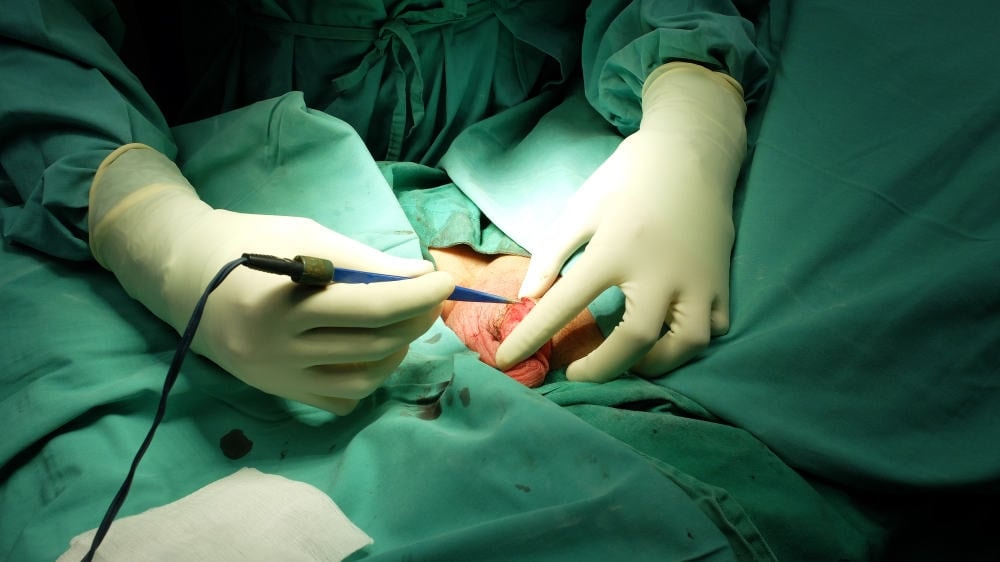 hep-bao-quy-dau-o-nam-gioi-anh-2