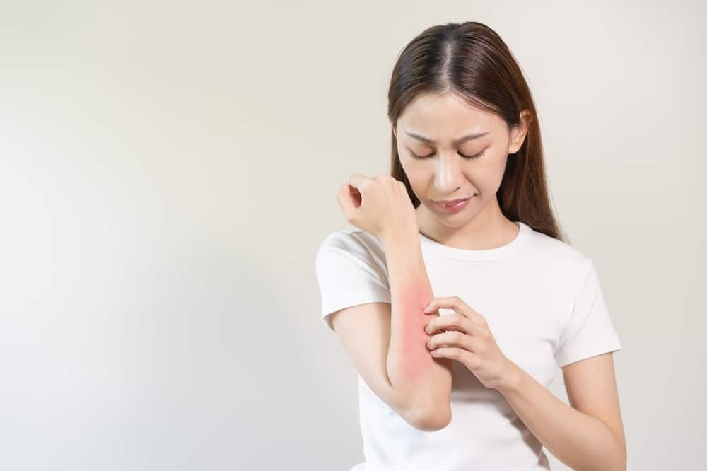 Bị dị ứng khi uống rượu bia