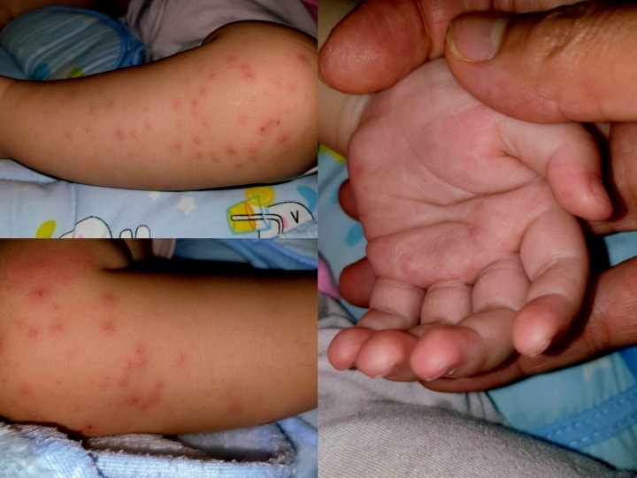 so-ca-mac-tay-chan-mieng-tang-cao-gay-ra-thieu-thuoc-anh-3