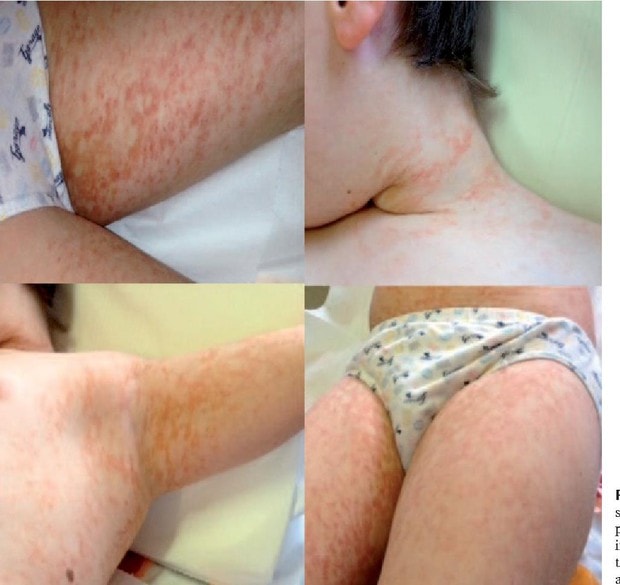 tac-hai-cua-paracetamol-khi-bi-lam-dung-anh-2