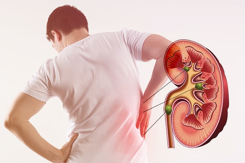 Dấu hiệu cần đi khám thận