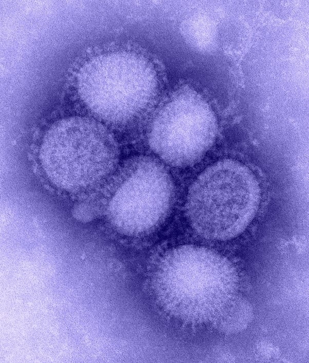 Virus cúm A/H1pdm09 dưới kính hiển vi