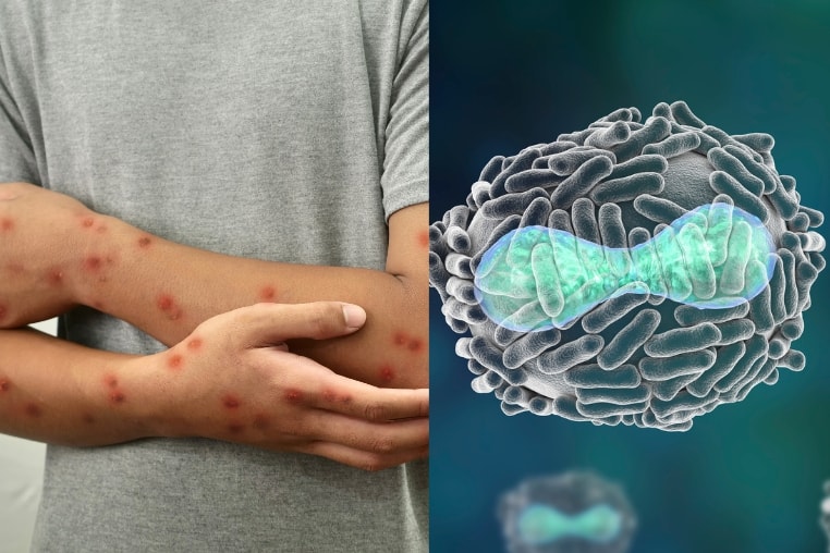 variola-virus.jpg