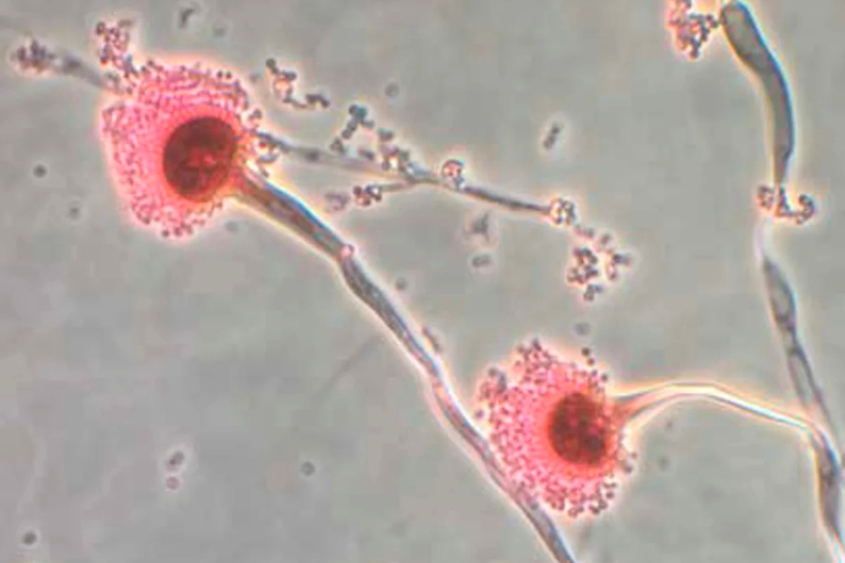 Aspergillus, một loại nấm, đang mở rộng phạm vi sinh sống khi Trái đất nóng lên, theo một nghiên cứu mới. (Nguồn: Trung tâm Kiểm soát và Phòng ngừa Dịch bệnh Hoa Kỳ – CDC / Reuters)