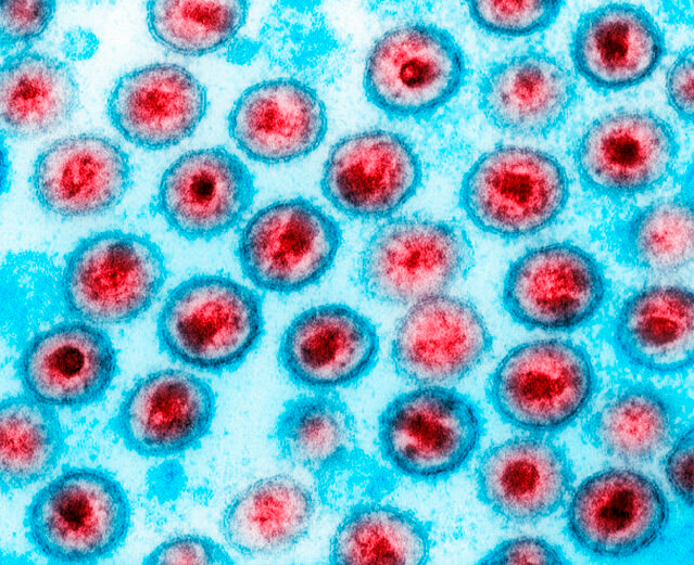Virus HIV-1 dưới kính hiển vi điện tử