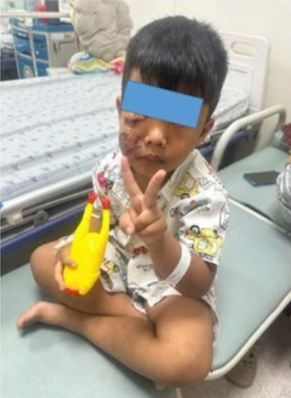 chó cắn
