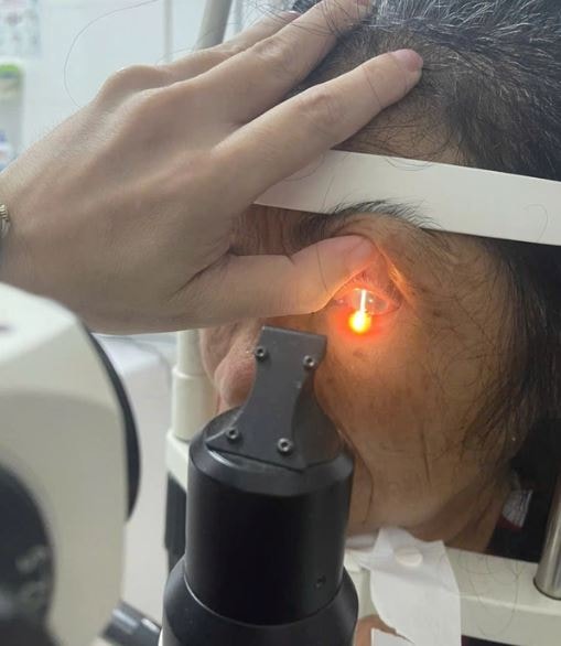 Người phụ nữ 61 tuổi bỏng mắt vì loại hạt quen thuộc - Ảnh 2.