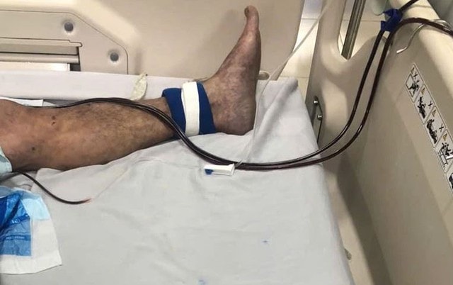 Tiếp xúc với loại thịt này, người đàn ông 61 tuổi suýt tử vong - Ảnh 1.