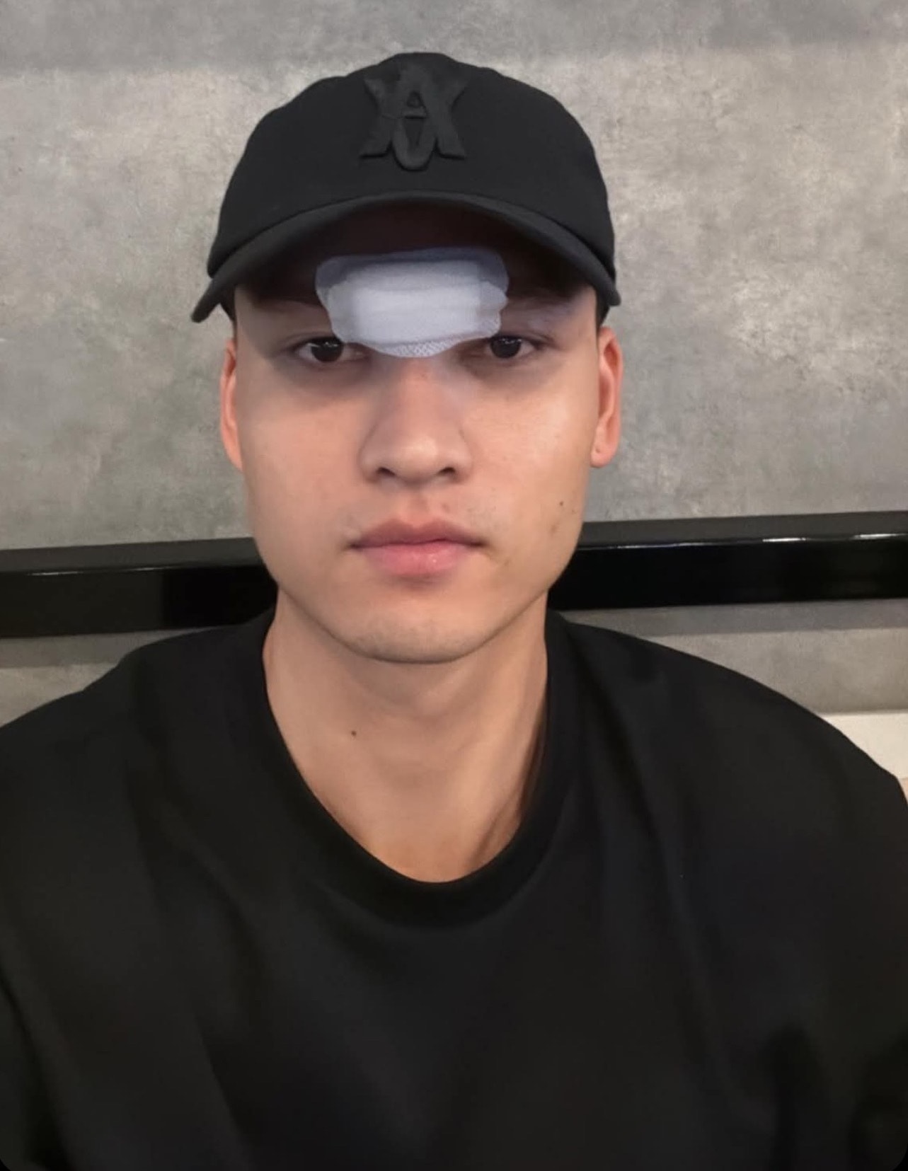 Bùi Hoàng Việt Anh phải khâu 14 mũi ở vùng trán.