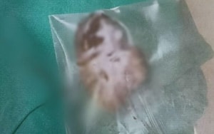 Người đàn ông đột ngột mất thị lực, bác sĩ phát hiện ra bí mật đáng sợ- Ảnh 3.