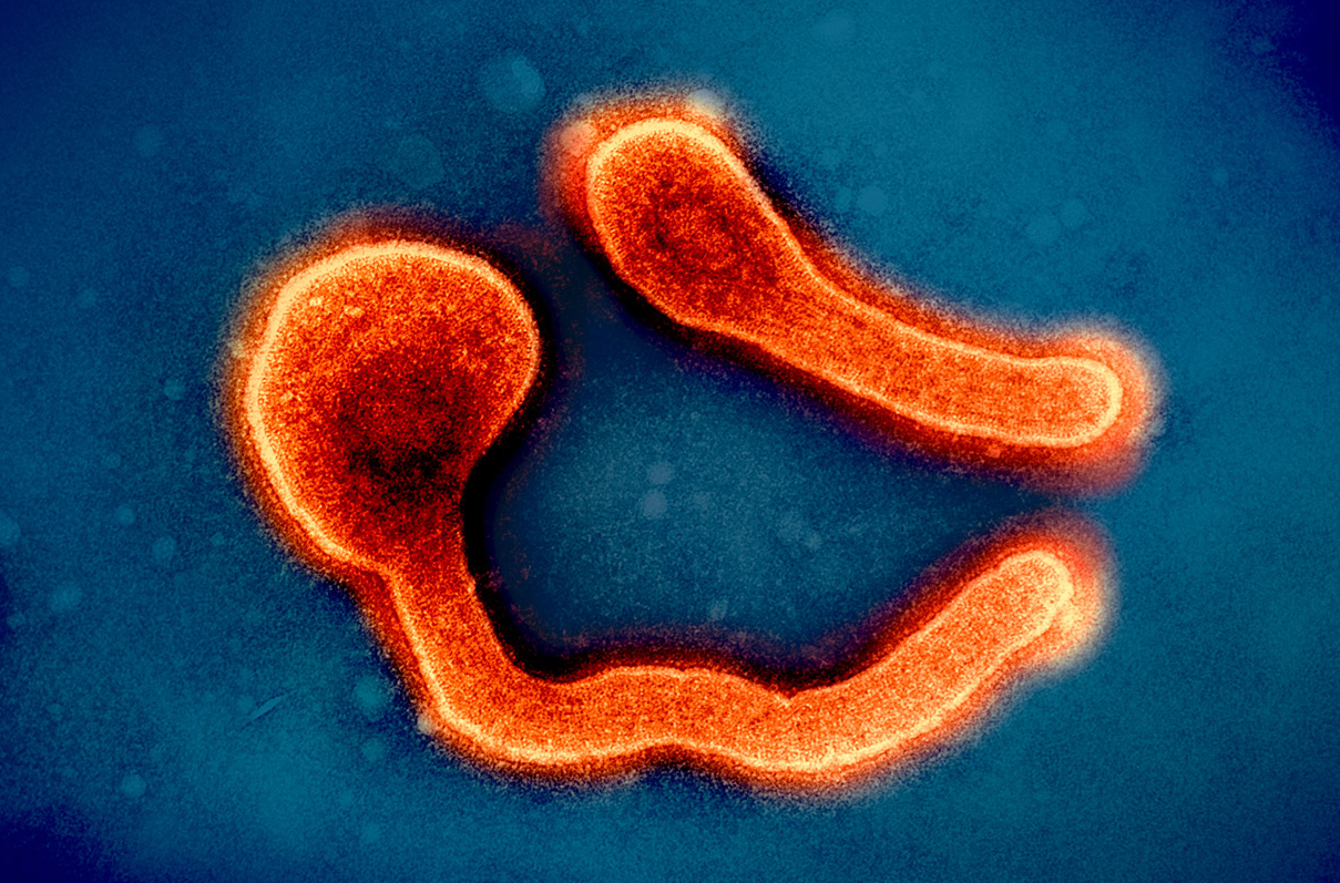 marburg-virus.png