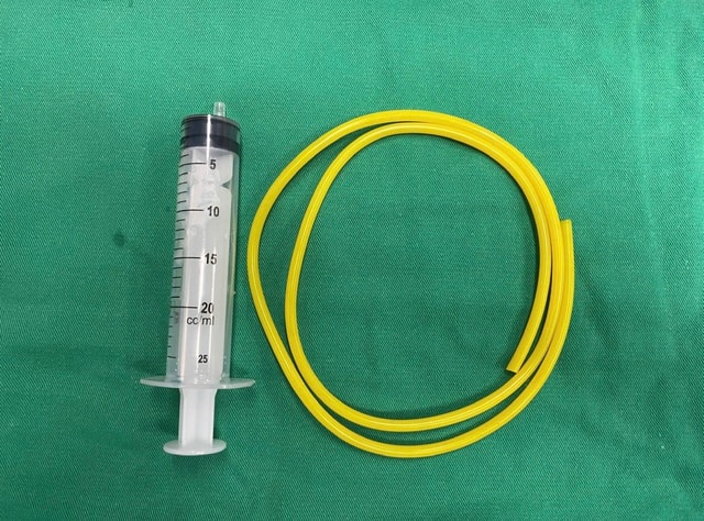 Người đàn ông 36 tuổi bị tiểu buốt, đi khám các bác sĩ phát hiện "bí mật đáng sợ" - Ảnh 2.