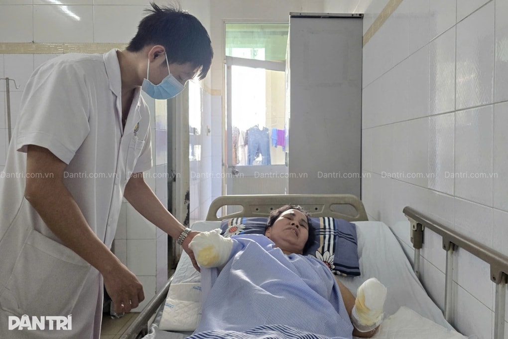 Bỏng điện cao thế, người phụ nữ nghèo mất đôi tay, khó giữ được chân trái - 1