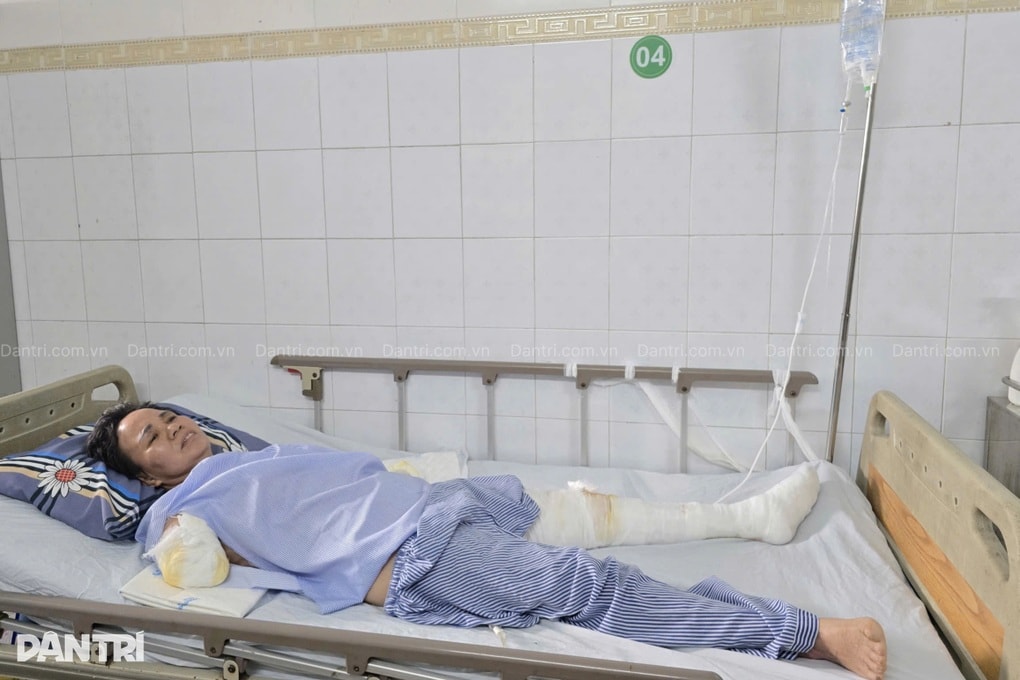 Bỏng điện cao thế, người phụ nữ nghèo mất đôi tay, khó giữ được chân trái - 2