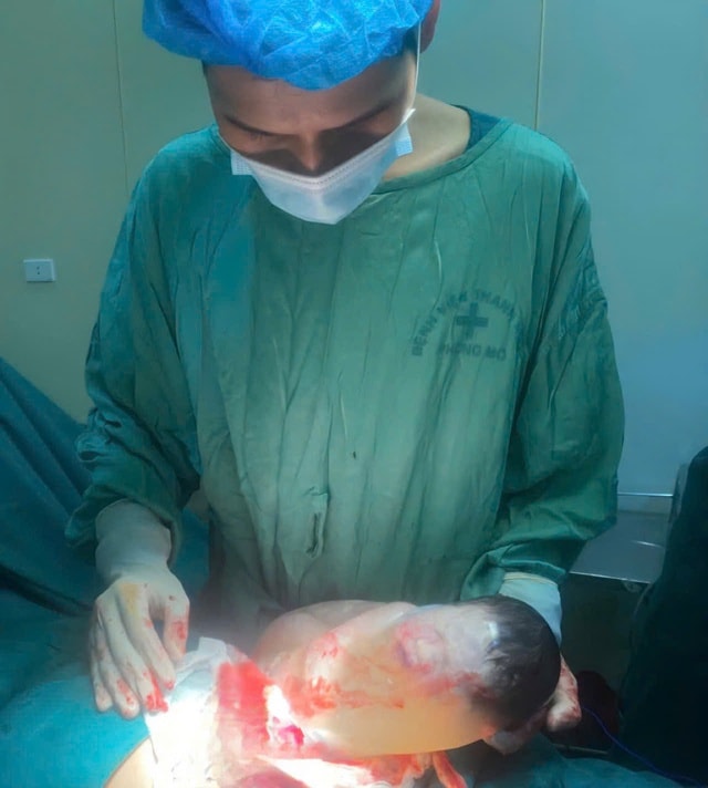 Hiếm gặp: Bé sơ sinh chào đời còn nguyên trong bọc ối- Ảnh 1.