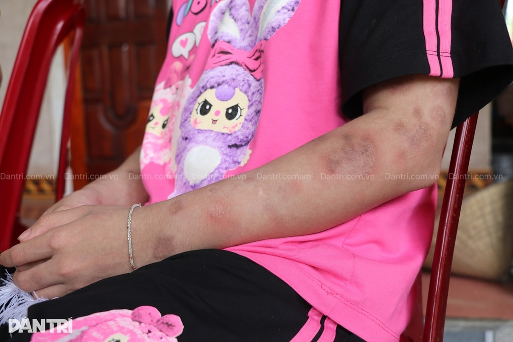 Cuốn bệnh án đẫm nước mắt của người mẹ nghèo có con gái mắc bệnh lạ - 3