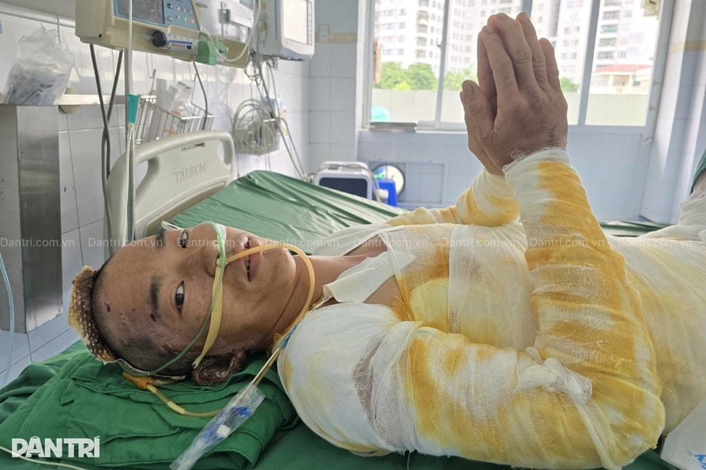 Người bố trẻ dân tộc Mông bỏng 64% cơ thể chắp tay khẩn cầu: “Xin cứu em!” - 5