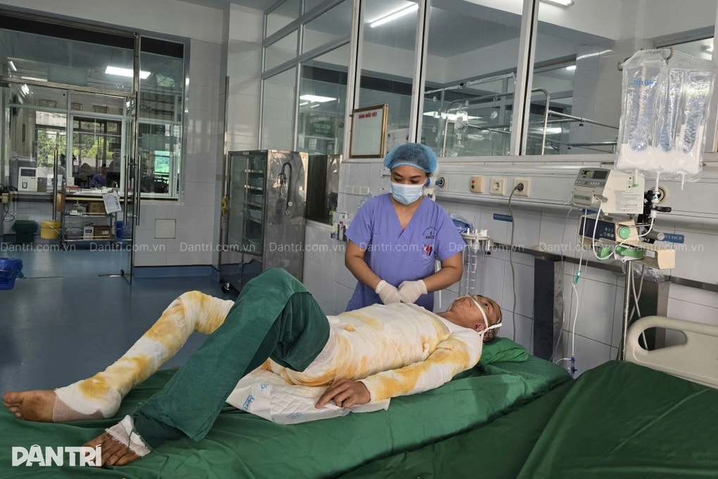 Người bố trẻ dân tộc Mông bỏng 64% cơ thể chắp tay khẩn cầu: “Xin cứu em!” - 1