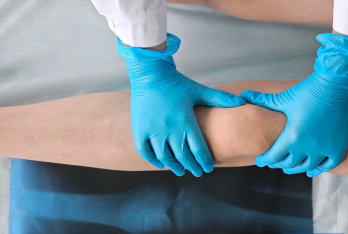 Một số người mặc cảm vì chiều cao đã phẫu thuật cắt xương để được thấp hơn. Ảnh minh họa: Shutterstock