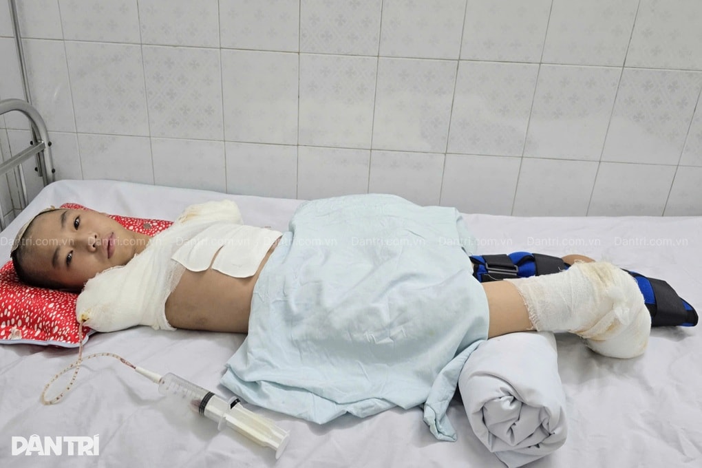 Đau nhói lòng cảnh cậu bé bị dòng điện cao thế cướp đi tương lai - 3