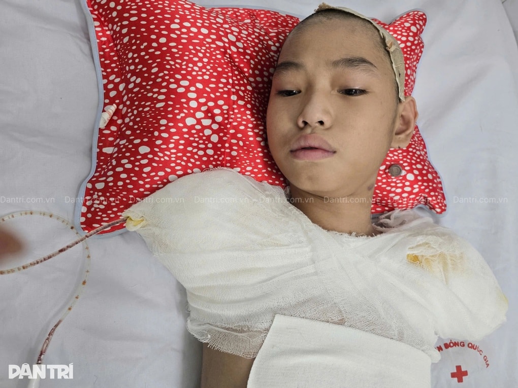 Đau nhói lòng cảnh cậu bé bị dòng điện cao thế cướp đi tương lai - 2