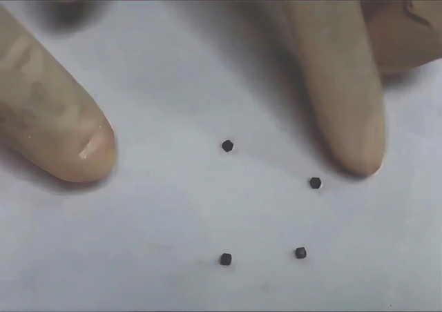 Bé trai 6 tuổi đau nhói bụng, bác sĩ gắp ra "thứ đáng sợ" bên trong- Ảnh 1.