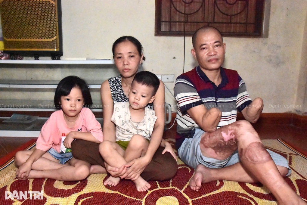 Bố tai nạn cụt 2 tay, mẹ thường đau yếu, 6 con lâm cảnh bế tắc - 2 Bố tai nạn cụt 2 tay, mẹ thường đau yếu, 6 con lâm cảnh bế tắc - 2