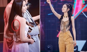 Xương lưng cánh bướm của Địch Lệ Nhiệt Ba bị cho là 'độc hại'