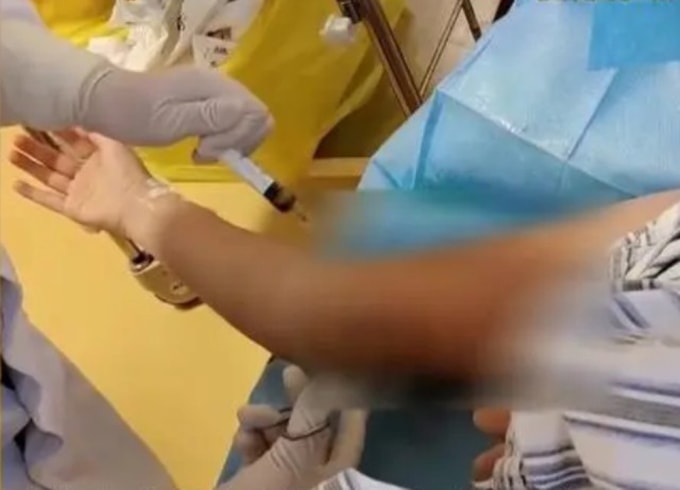 Tiêm tan mỡ tại cơ sở làm đẹp, người phụ nữ bị khoét 57 lỗ trên tay - 1