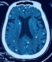 Chụp X-quang ngực cho người phụ nữ 77 tuổi, bác sĩ sốc nặng khi phát hiện "bí mật đáng sợ" - Ảnh 1.