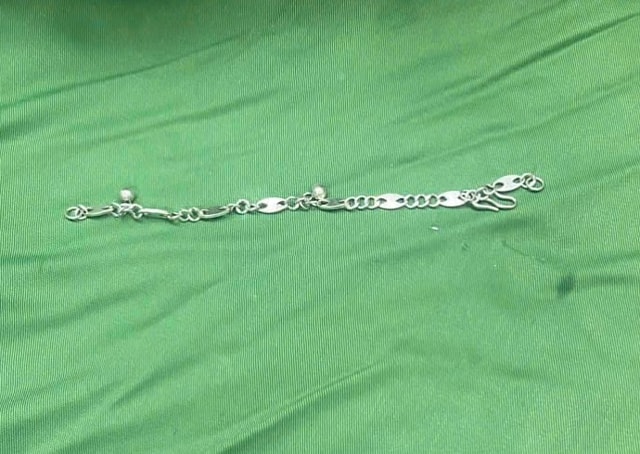 Bé gái 5 tuổi nghịch dại, bác sĩ gắp ra thứ "đáng sợ" bên trong bụng - Ảnh 1.