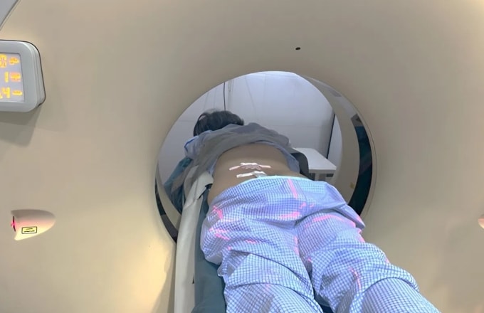 Bệnh nhân chụp CT Scan tại Bệnh viện Nhân dân Gia Định. Ảnh: Bệnh viện cung cấp
