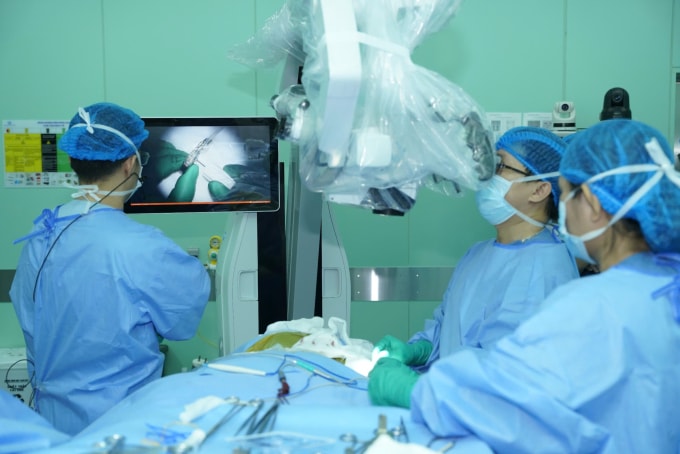 Các bác sĩ thực hiện ca phẫu thuật cấy thiết bị kích thích dây thần kinh phế vị (VNS) đầu tiên tại Việt Nam trên một bệnh nhân bị động kinh kháng thuốc. Ảnh: Bệnh viện cung cấp