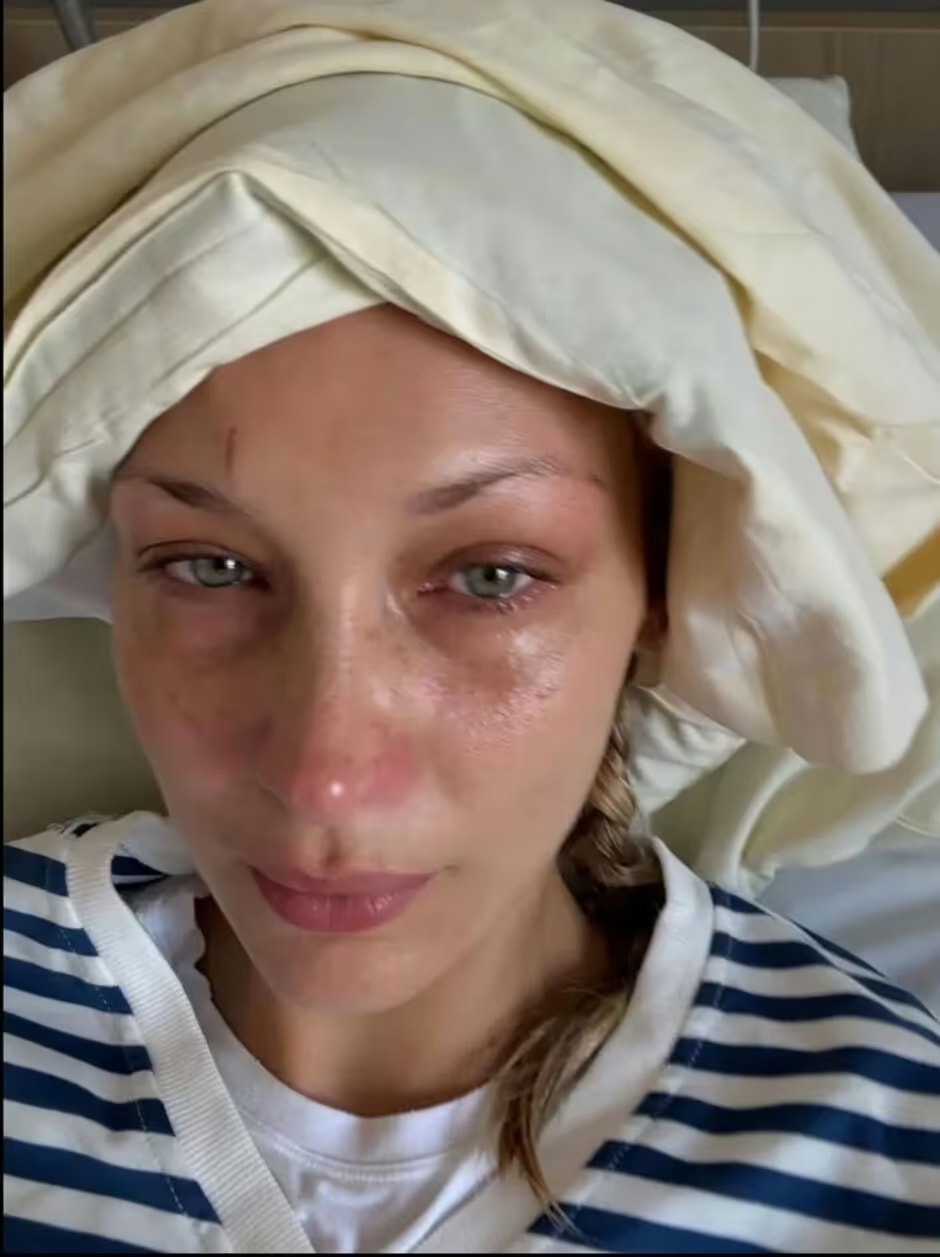 Bella Hadid ảnh 1 Bella Hadid anh 1