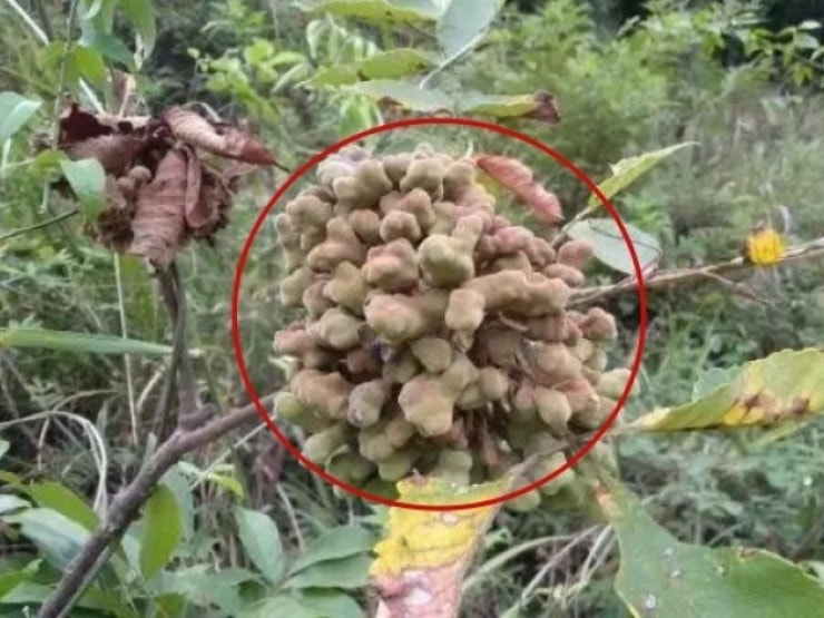 Nguy kịch sau khi tự trích mụn nhọt tại nhà - Ảnh 2.