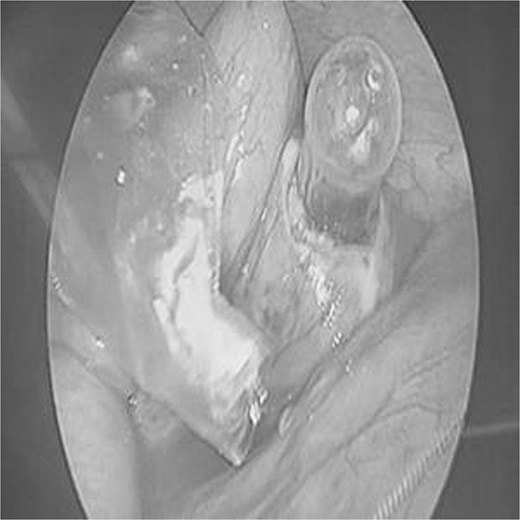 Bé trai 10 tuổi nôn mửa, đau bụng suốt 4 ngày, bác sĩ sốc nặng khi phát hiện "bí mật" đáng sợ - Ảnh 2.