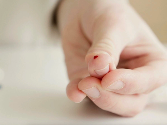 Người mắc hội chứng sợ máu có thể ngất xỉu dù chỉ thấy một vệt máu nhỏ. Ảnh minh họa: Pexels