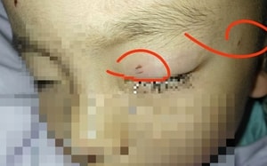 Chú chó liều mình tử chiến với rắn hổ mang để cứu chủ và cái kết- Ảnh 2. Chú chó liều mình tử chiến với rắn hổ mang để cứu chủ và cái kết- Ảnh 2.