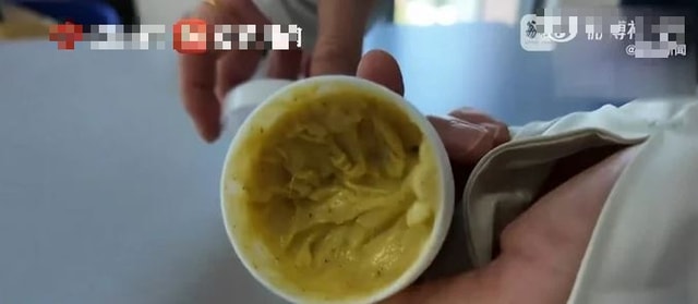 Người phụ nữ 40 tuổi, da biến dạng kinh hoàng vì sai lầm nhiều người mắc- Ảnh 1. Người phụ nữ 40 tuổi, da biến dạng kinh hoàng vì sai lầm nhiều người mắc- Ảnh 1.