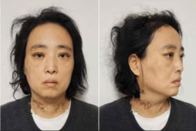 Myeong Jae-wan khi bị bắt, tháng 3/2024. Ảnh: Chosun Daily