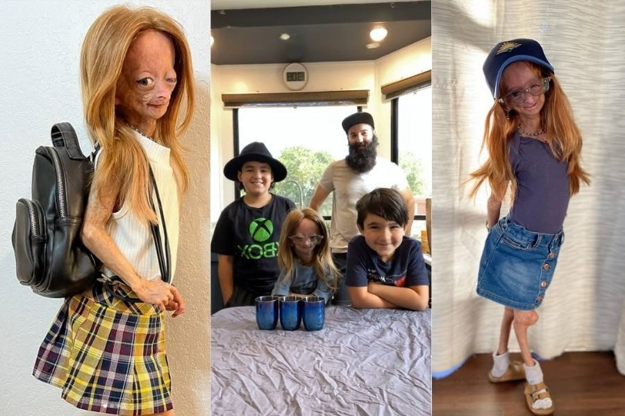 Adalia Rose Williams là một minh chứng cho cuộc sống đầy phi thường (Instagram: @adalia06)