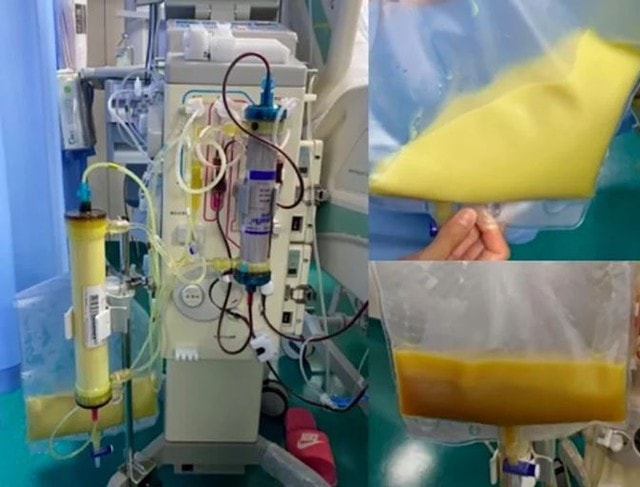 Người phụ nữ 27 tuổi "máu trắng đục" vì thường xuyên uống thứ nước vạn người mê- Ảnh 1. Người phụ nữ 27 tuổi "máu trắng đục" vì thường xuyên uống thứ nước vạn người mê- Ảnh 1.