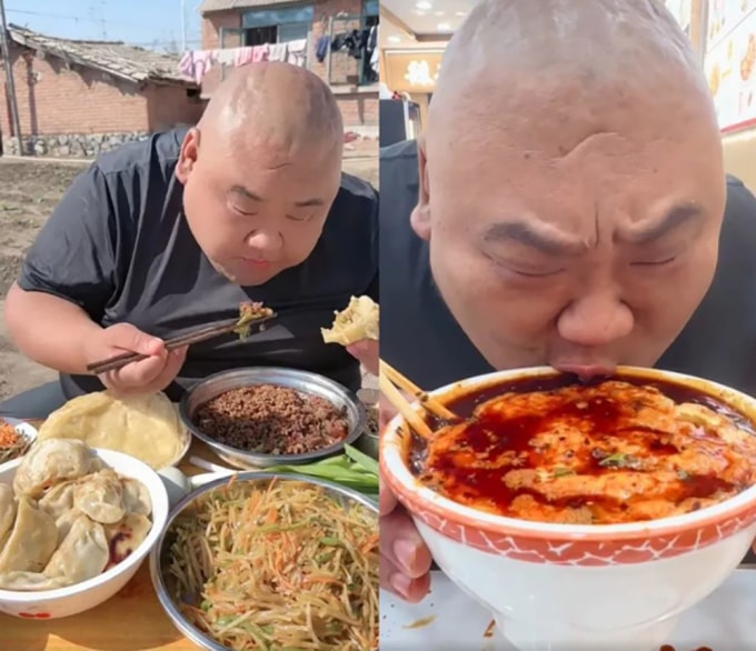 Mặt trái mukbang khiến blogger 175 kg phải cắt 80% dạ dày - 1