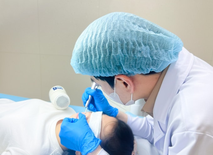 Bác sĩ xóa nốt ruồi cho trẻ bằng laser CO2. Ảnh: Bệnh viện Đa khoa Tâm Anh