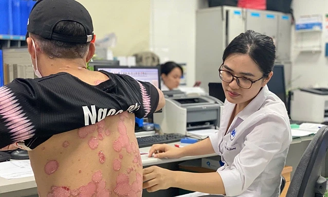 Một bệnh nhân mắc vảy nến khám tại Bệnh viện Da liễu Trung ương. Ảnh: Hương Nguyễn