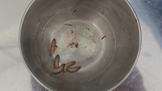Người phụ nữ 48 tuổi đau tai dữ dội, bác sĩ gắp ra "thứ đáng sợ" bên trong- Ảnh 1. Người phụ nữ 48 tuổi đau tai dữ dội, bác sĩ gắp ra "thứ đáng sợ" bên trong- Ảnh 1.