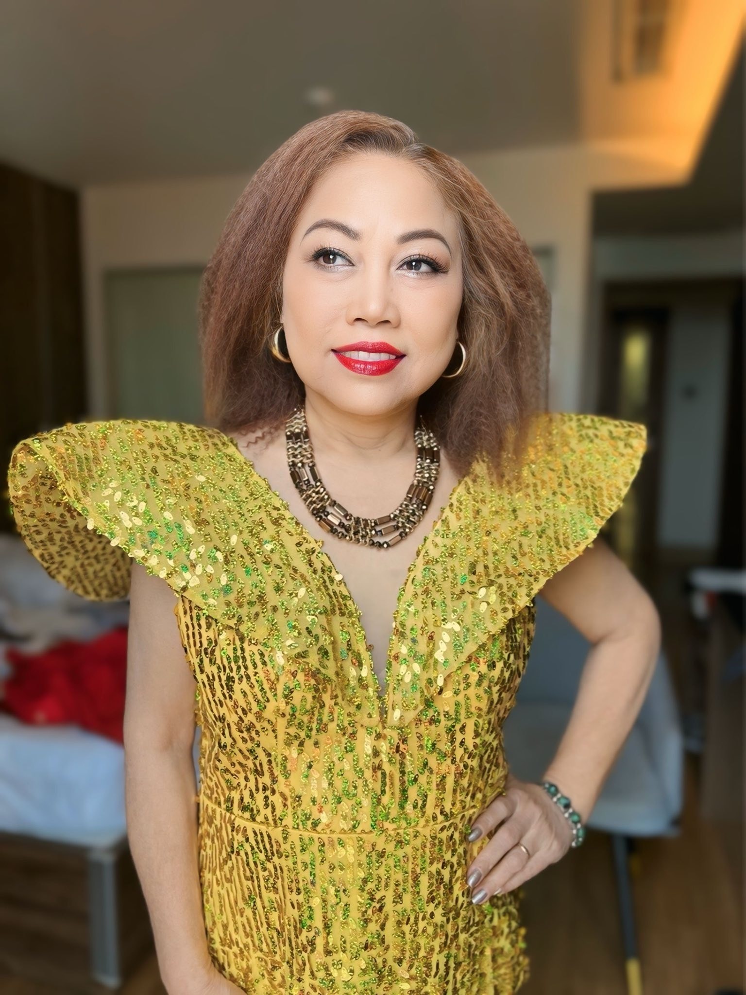 Siu Black nguy kịch ảnh 5 Siu Black nguy kich anh 5