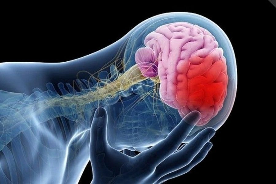 Đột quỵ có khả năng đe dọa tính mạng và gây ra tàn phế nghiêm trọng (Pinterest)