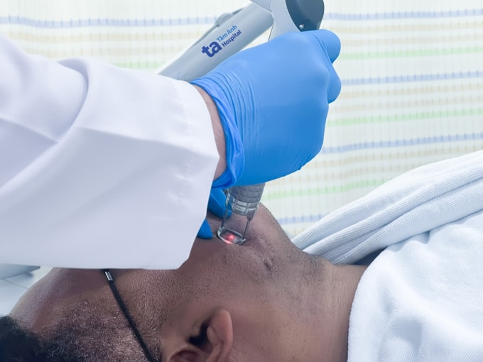 Bác sĩ sử dụng laser Erbium Fractional điều trị sẹo lồi cho anh Michael. Ảnh: Bệnh viện Đa khoa Tâm Anh